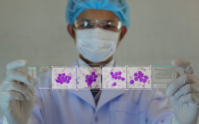 Doctor or Scientist looking a Leukemia cells