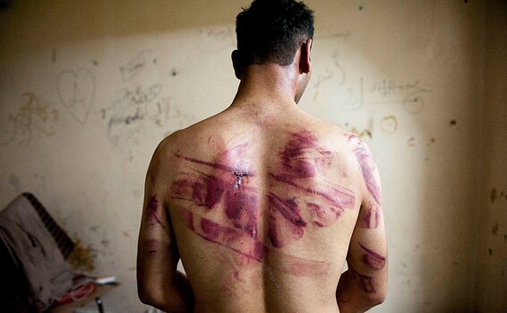FILES-SYRIA-10 YEARS-WAR