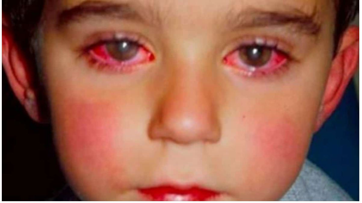 Un garçon de 7 ans presque aveugle à cause d'un jouet - JForum